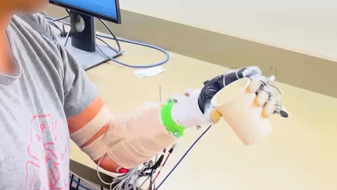 University of Utah AI-controlled bionic hand picking up a cotton ball